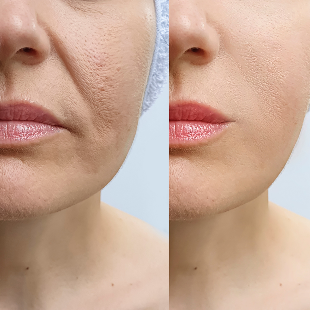 Protective Day Serum