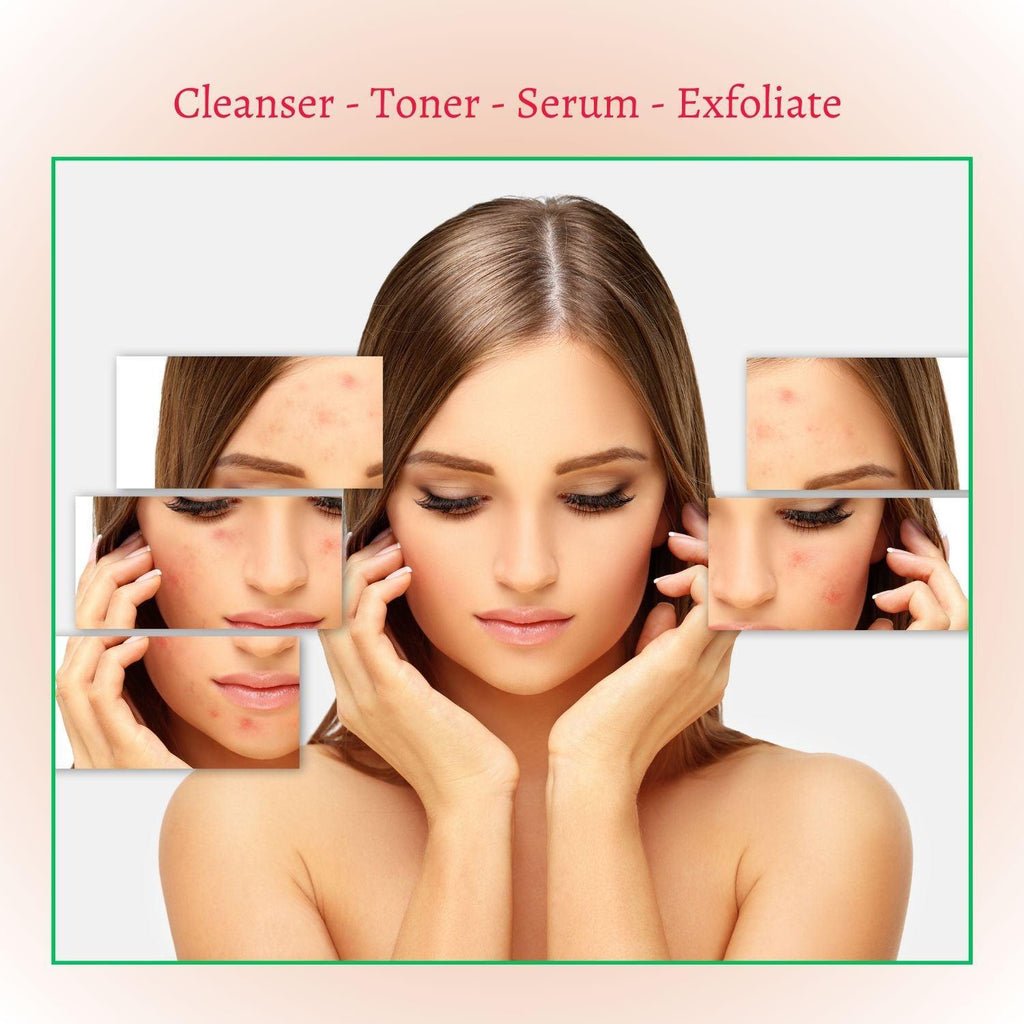 Deep Treatment Acne Cleansing Foam, Pore Clarifying Korean Wash
