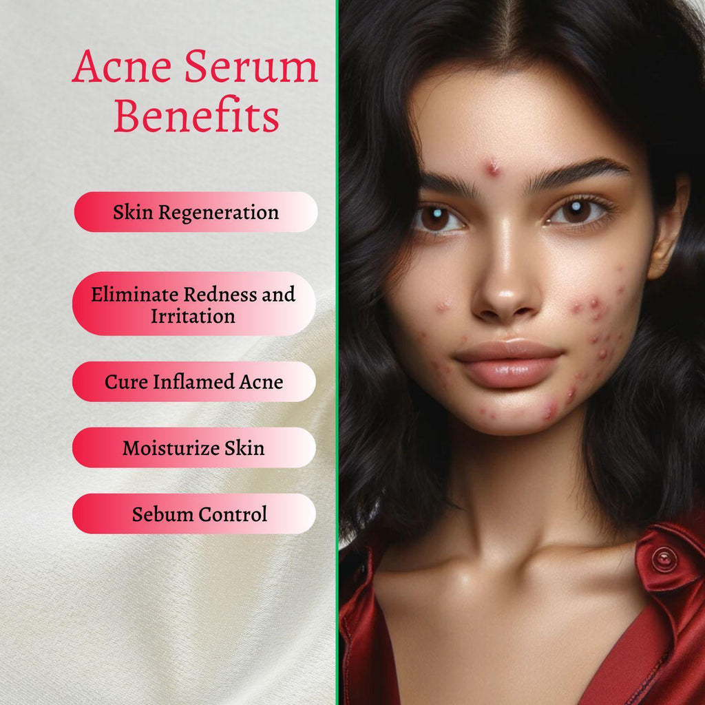 Intensive Acne Serum with Salix Alba and Green Tea Extract