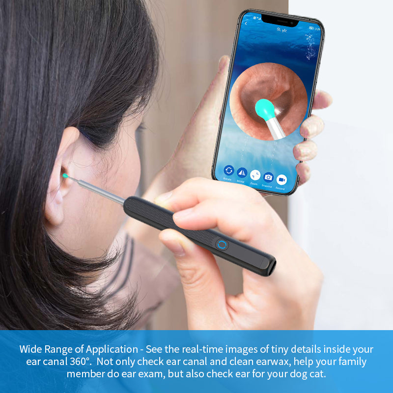 Wireless Ear Otoscope with Camera - HD Ear Wax Removal Tool Kit