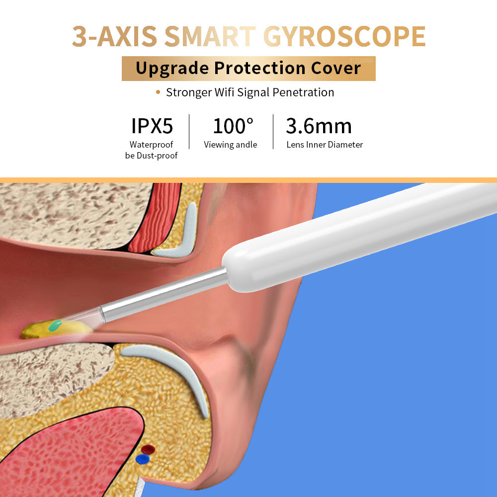 Wireless Ear Otoscope with Camera - HD Ear Wax Removal Tool Kit