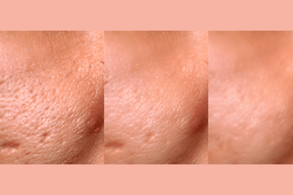 Anti-Aging Daily Exfoliating Pads with AHA, BHA, and PHA