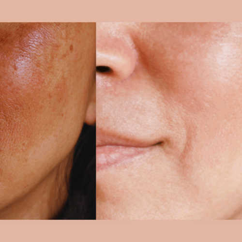 Anti-Aging Daily Exfoliating Pads with AHA, BHA, and PHA