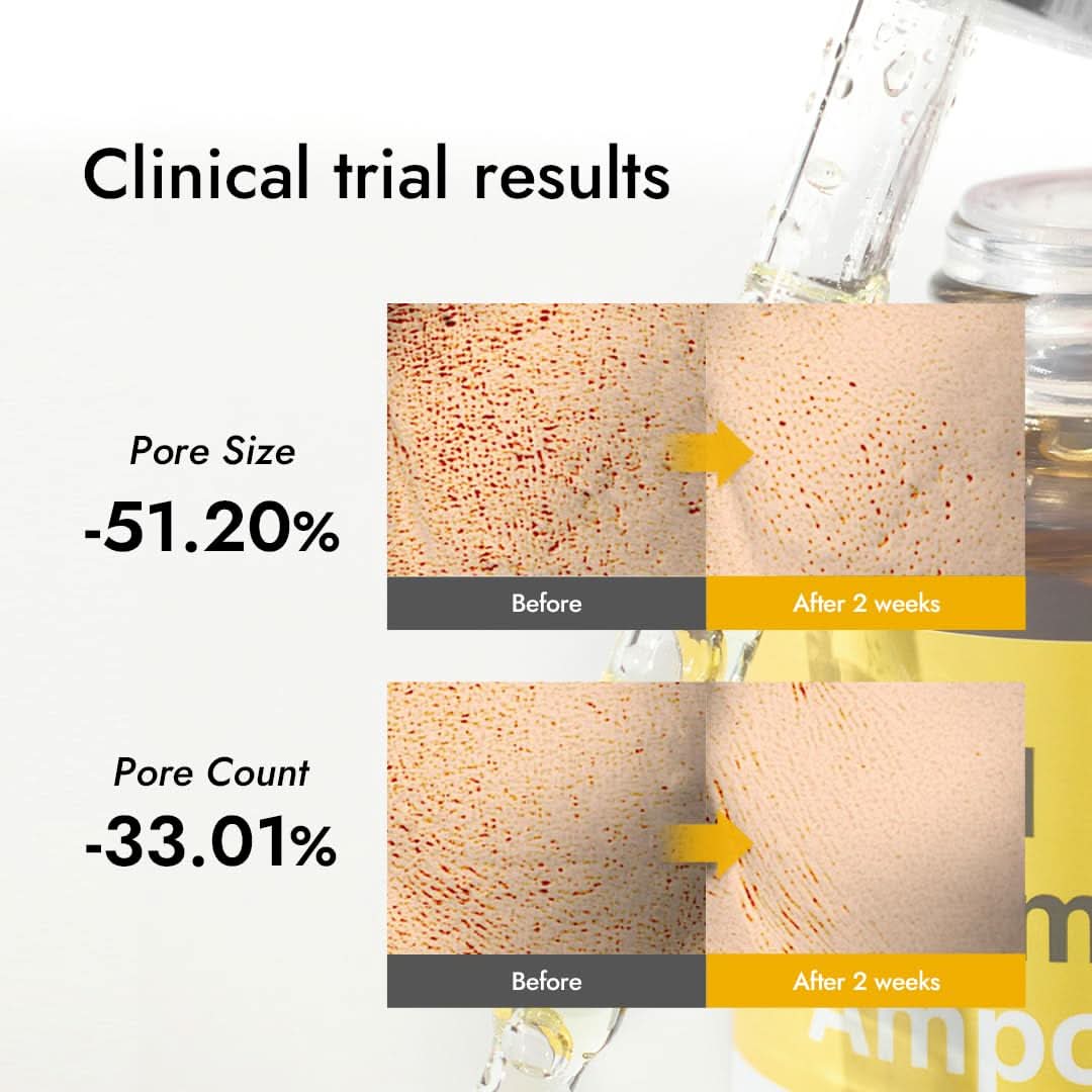 19% Pure Vitamin C Ampoule - Highly Concentrated Waterless Serum