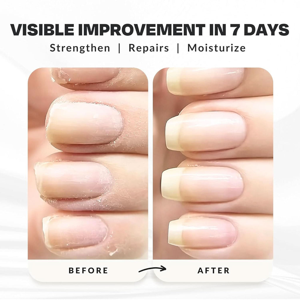 Power Boost Nail Growth & Strengthening Treatment 0.5 oz