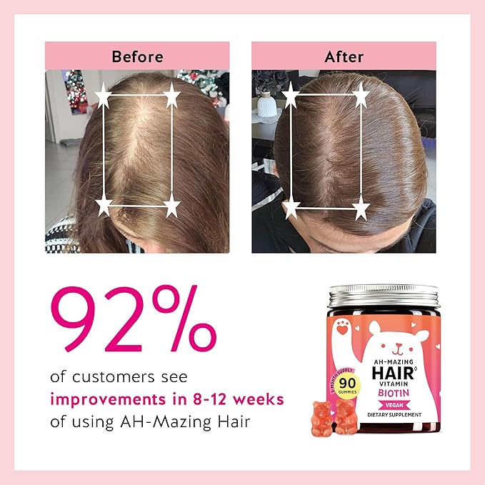 Biotin Gummies for Hair, Skin & Nails. 5,000 mcg High Potency Vegan Vitamins for Faster Hair Growth, Stronger Nails & Healthy Skin. with Vitamins C & E, 60 Gummies