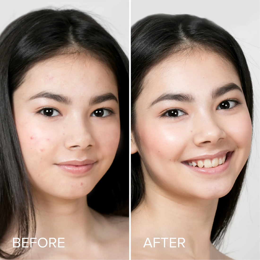 Hydrocolloid Acne Patches for Face Marine Collagen Skincare 72 Dots - Image 3