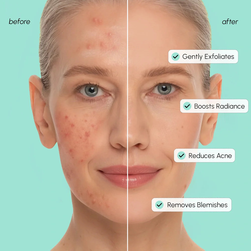 10% Azelaic Acid Soothing Toner Pads for Radiant Skin Tone - Image 4
