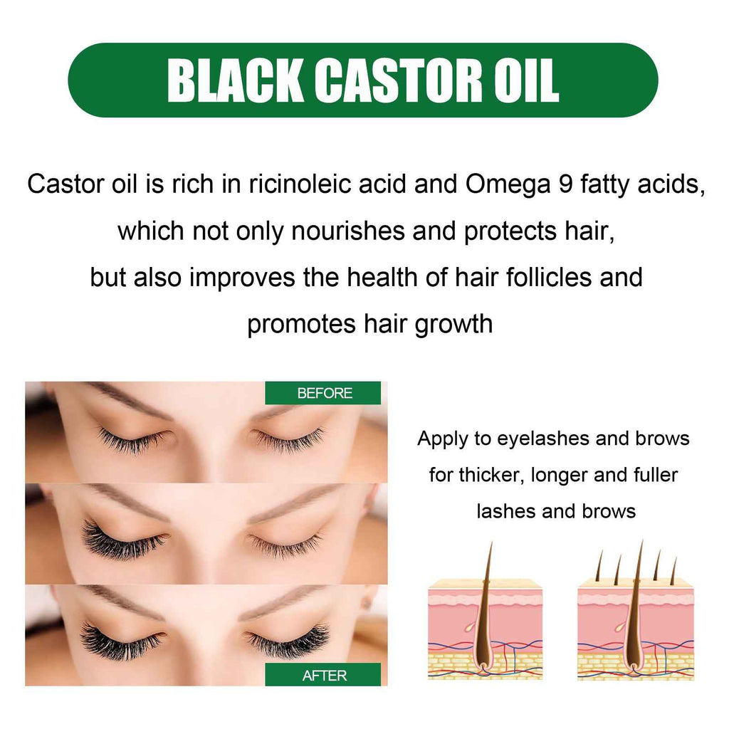 OUHOE Castor Oil Hair Conditioner, Nourishes Hair Roots Softens Hair And Prevents Loss Hair Conditioner