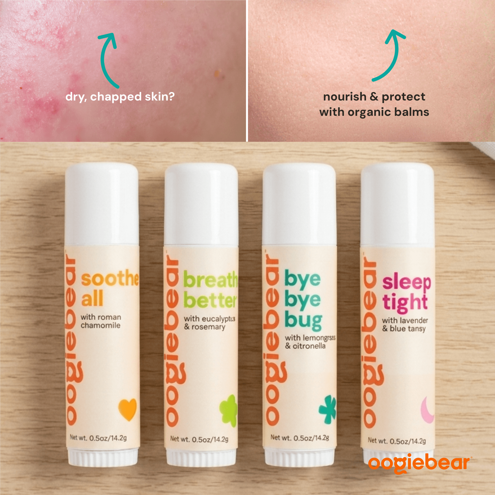 Organic Baby Balm Collection Set – 4-Piece Natural Skincare Kit