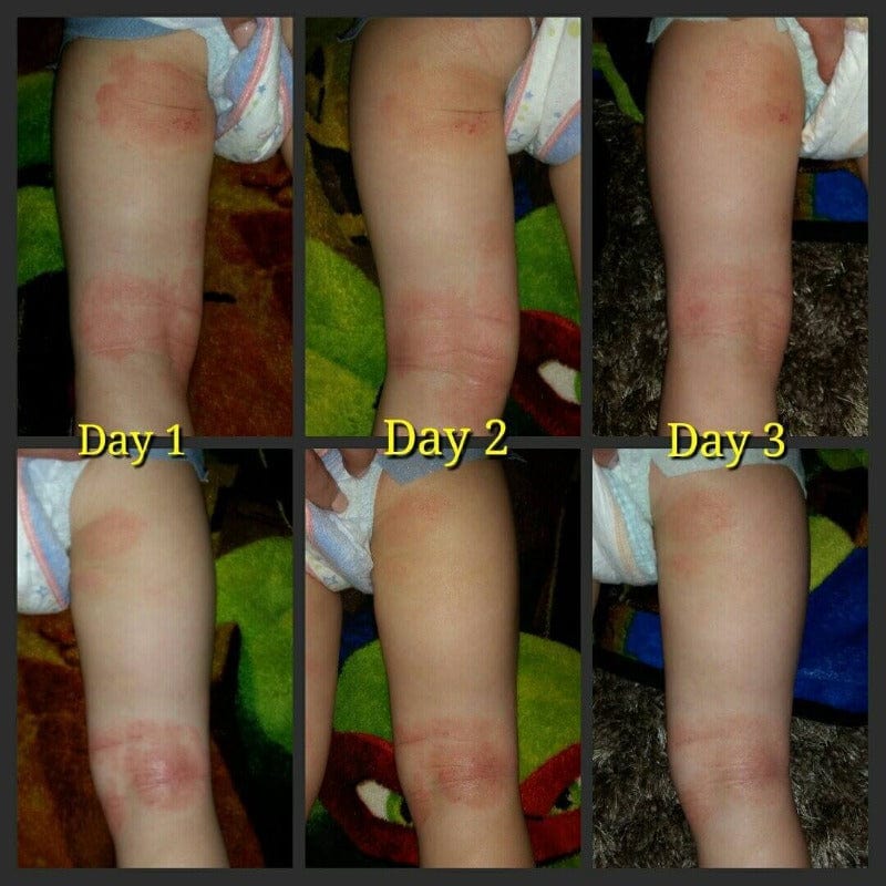 SOOTHE MY SKIN EMU OIL CREAM – Nature’s Healing Power Unleashed!