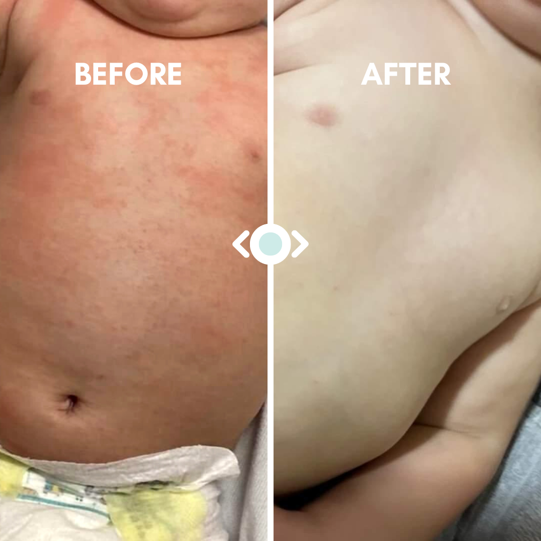 Baby Eczema Relief Bundle - Oatmeal & Balm