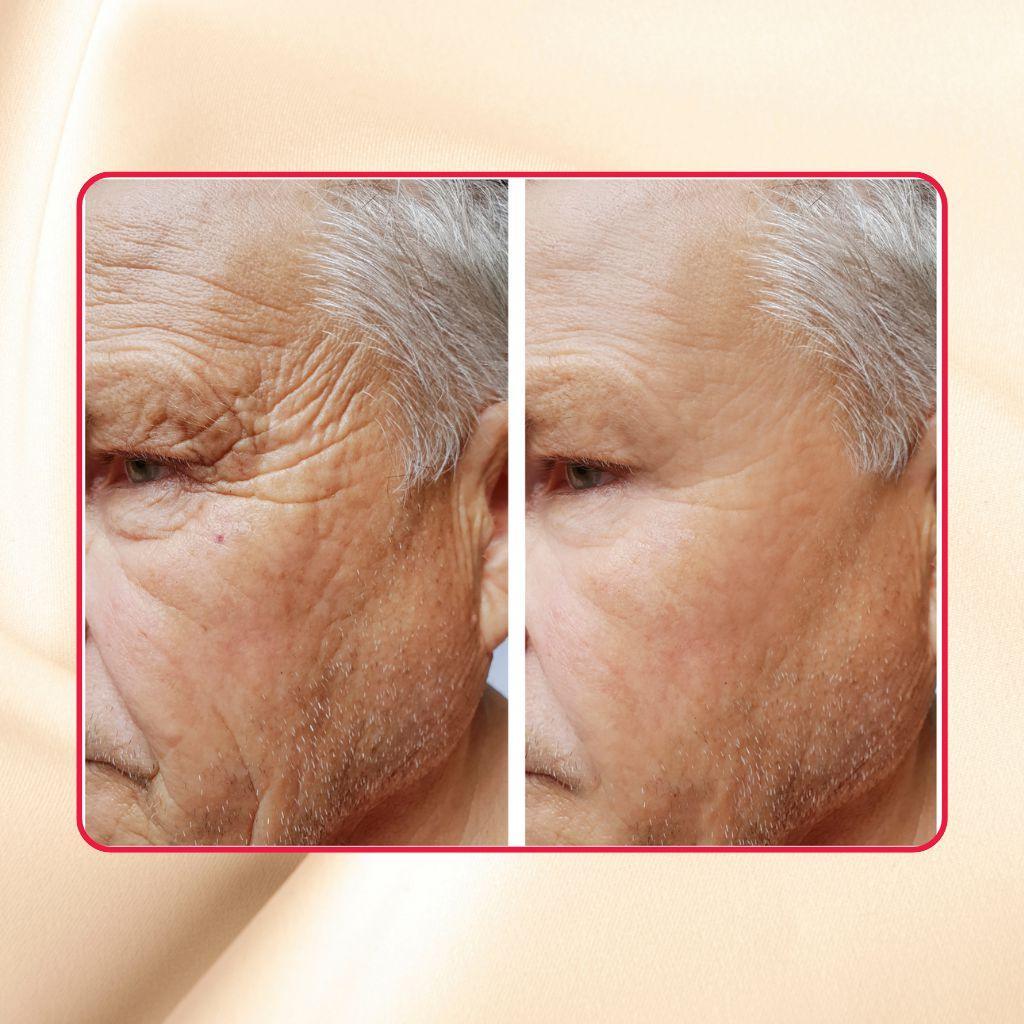 High-Strength Glycolic and Lactic Acid 30% Extreme Gel Peel