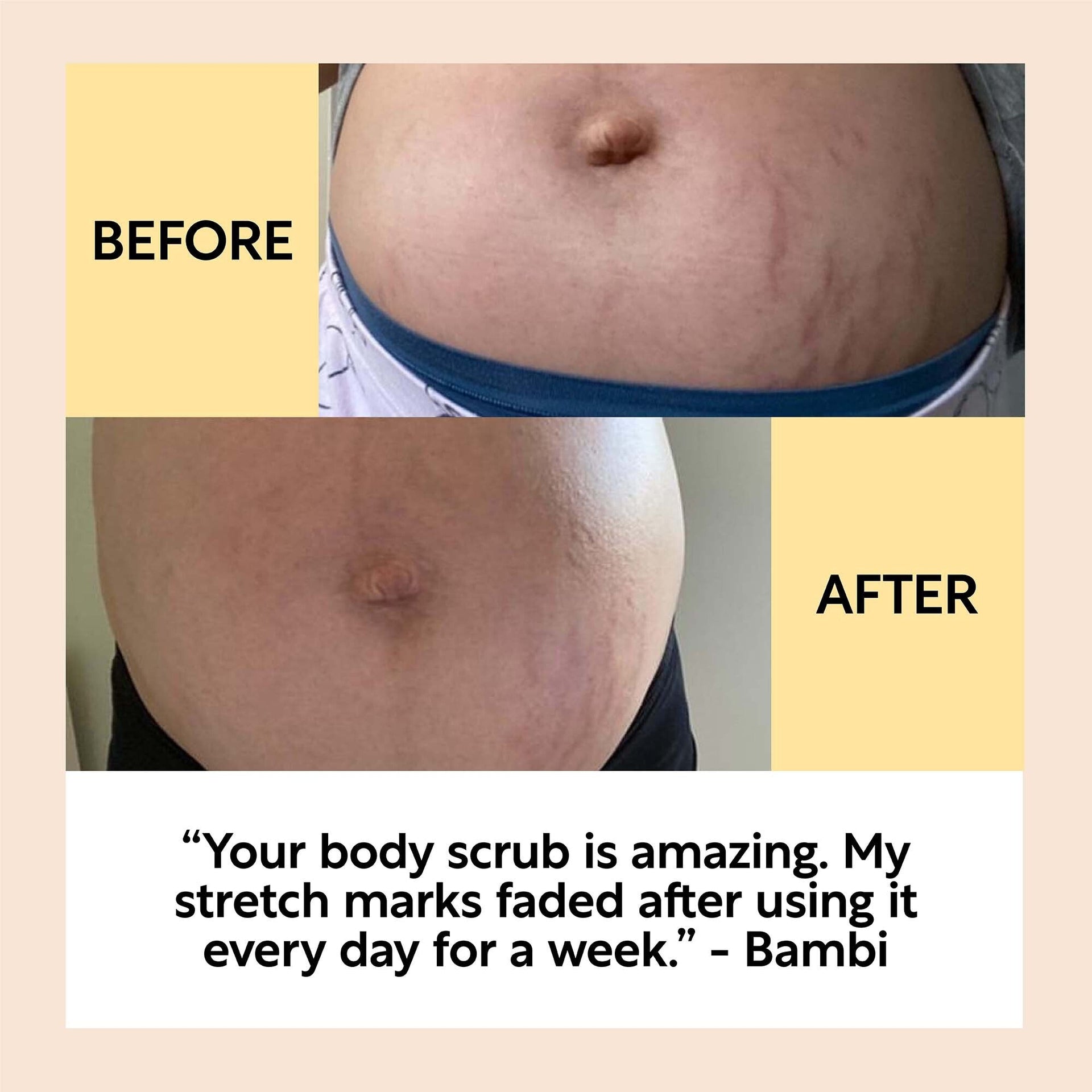 Bodycare Bundle