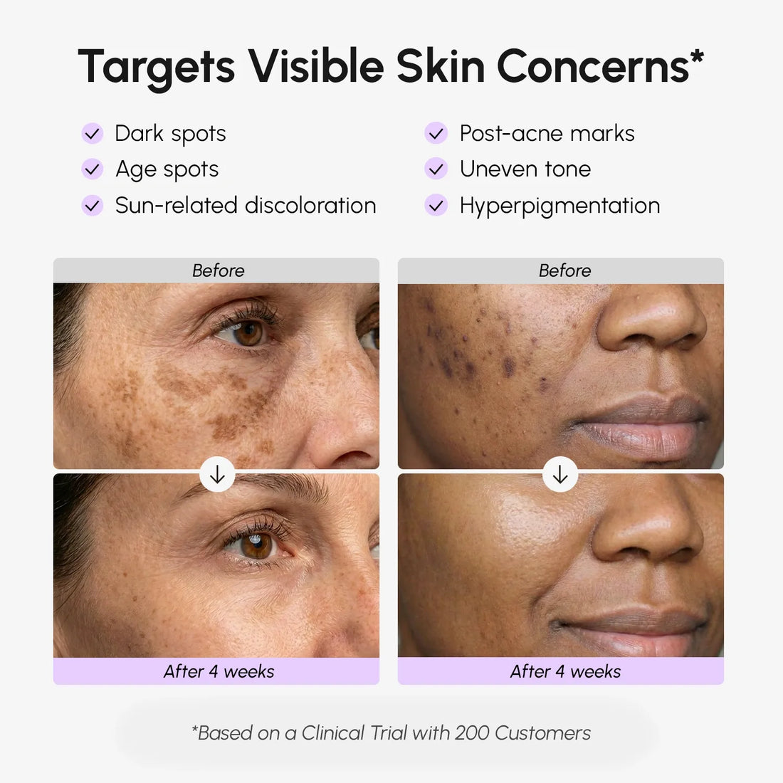Dark Spot Correcting Serum for Face and Body with Vitamin C - Image 3