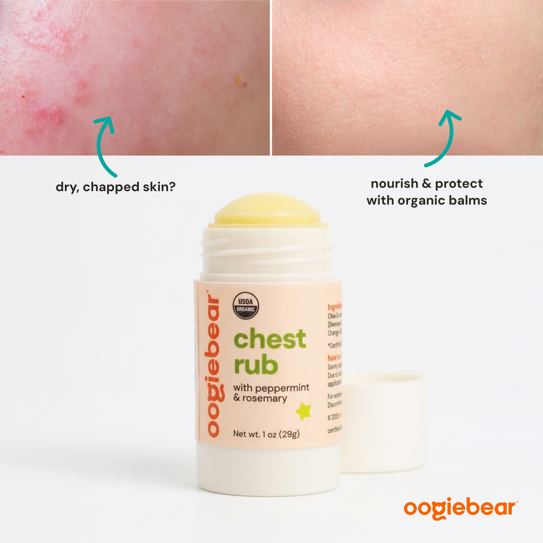 Organic Chest Rub Body Balm with Peppermint & Rosemary for Toddlers