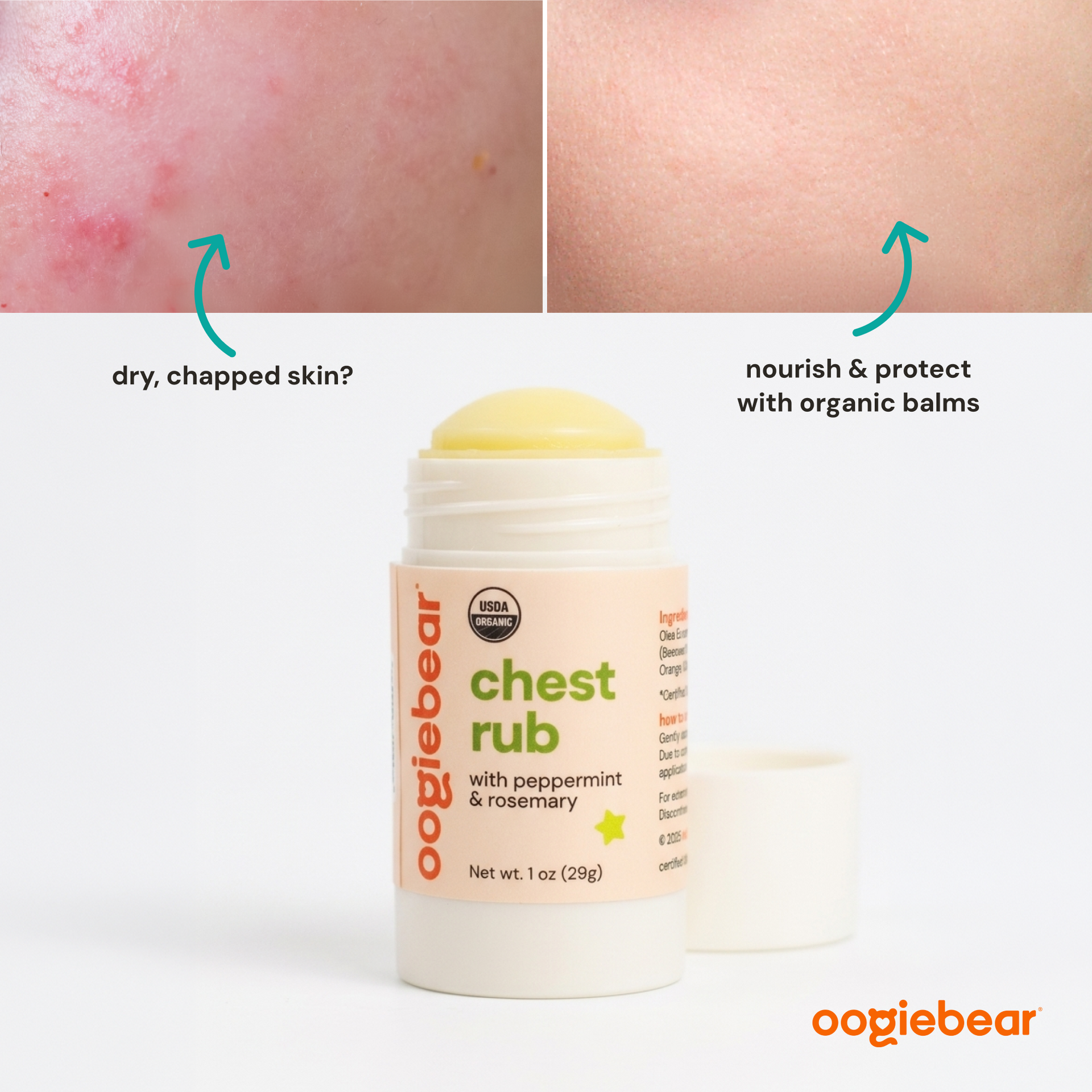 Organic Chest Rub Body Balm with Peppermint & Rosemary for Toddlers