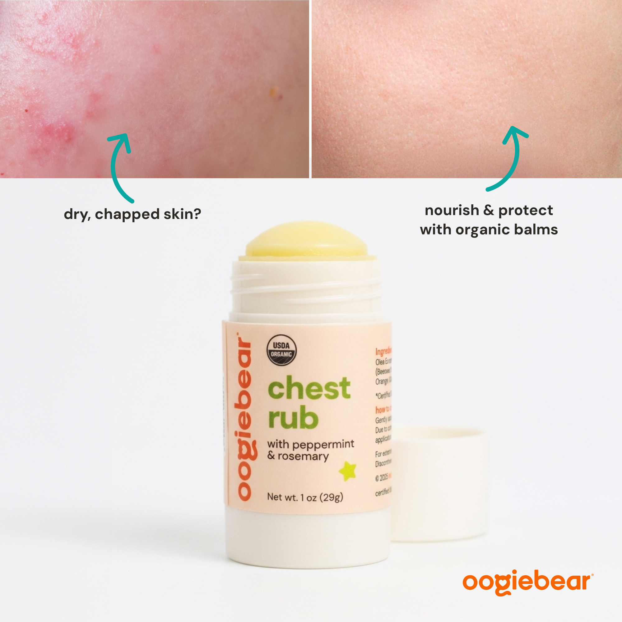 Organic Chest Rub Body Balm with Peppermint & Rosemary for Toddlers