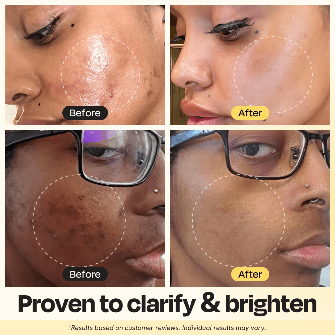 Vitamin C Clay Mask for Brightening and Clear Skin 2.5 oz - Image 2