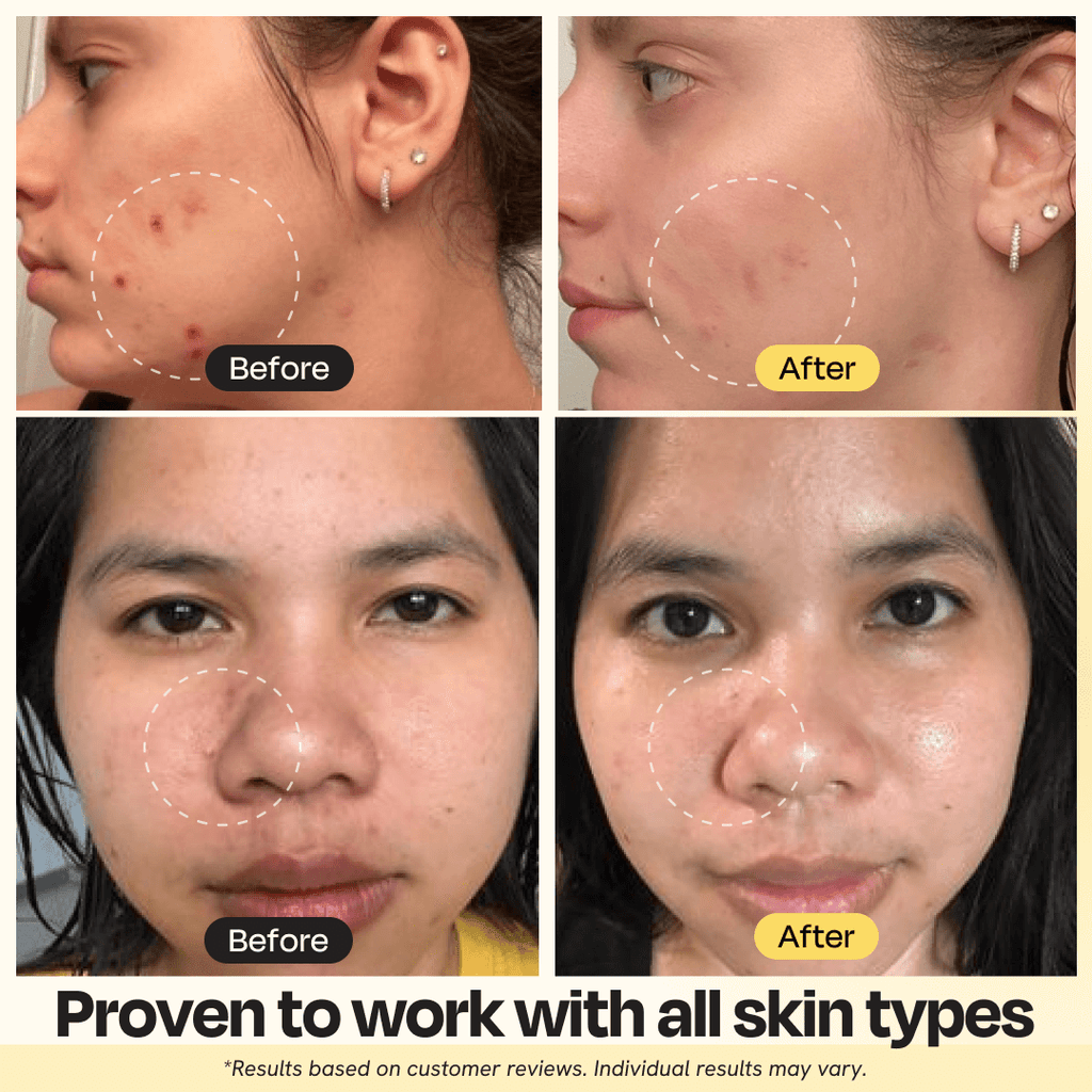 Vitamin C Clay Mask for Brightening and Clear Skin 2.5 oz - Image 4