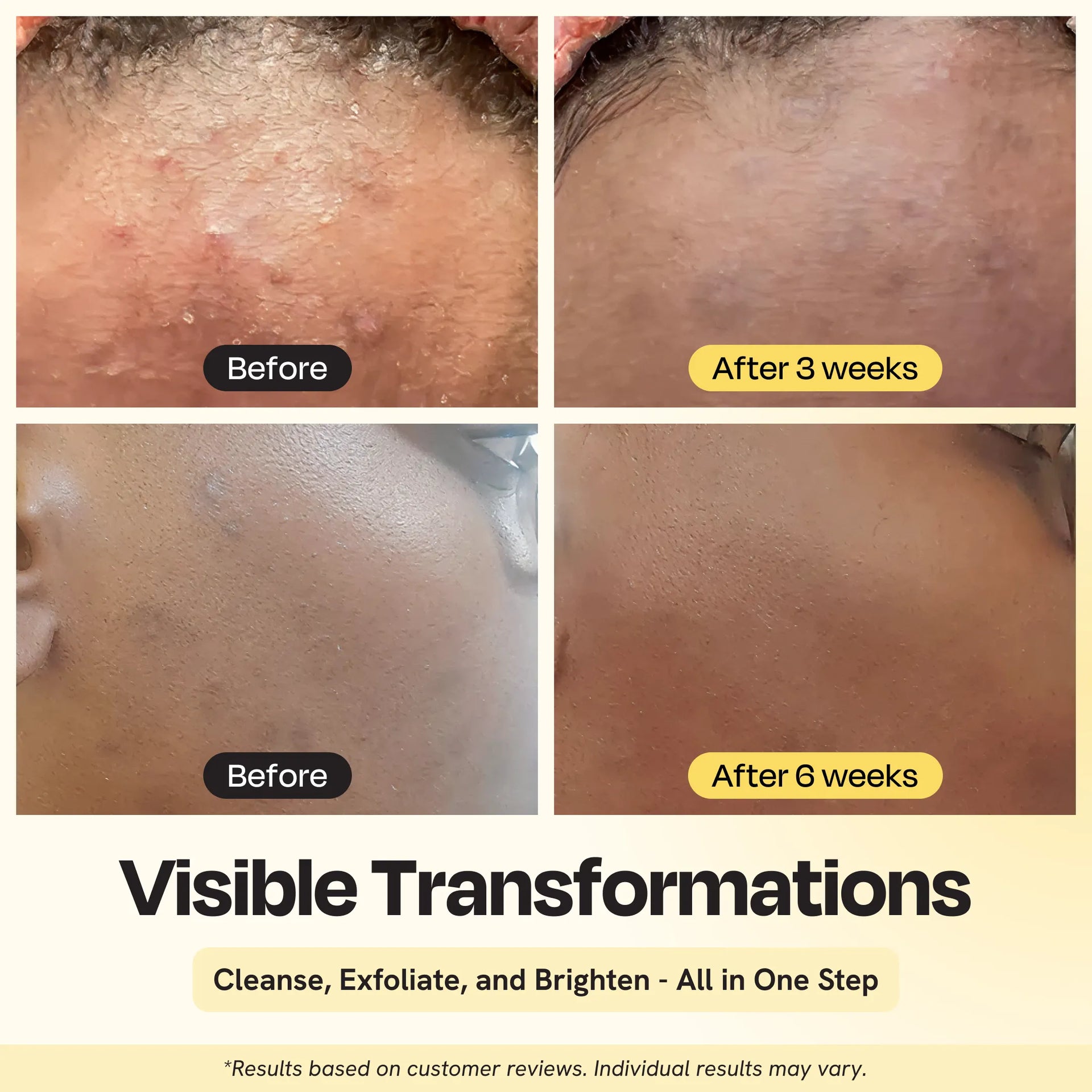 Clarifying Brightening Face Cleanser with Salicylic Acid and AHA - Image 5