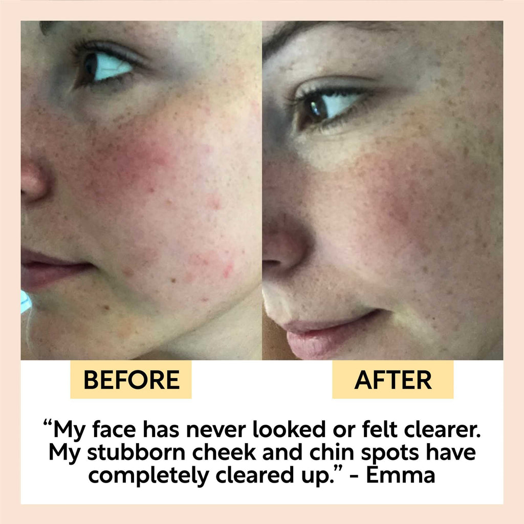 Chai Soap Cleansing Duo