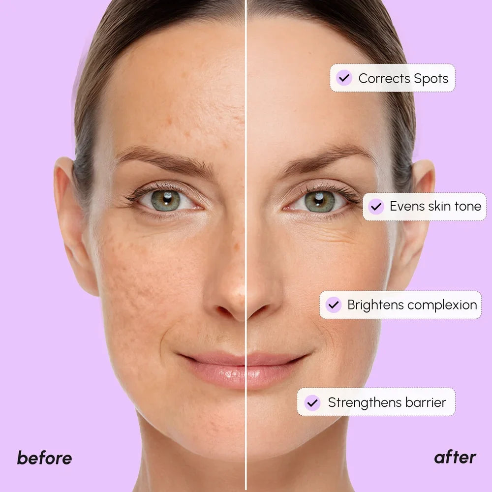 20% Tranexamic Acid Face Serum for Dark Spot Correction - Image 4