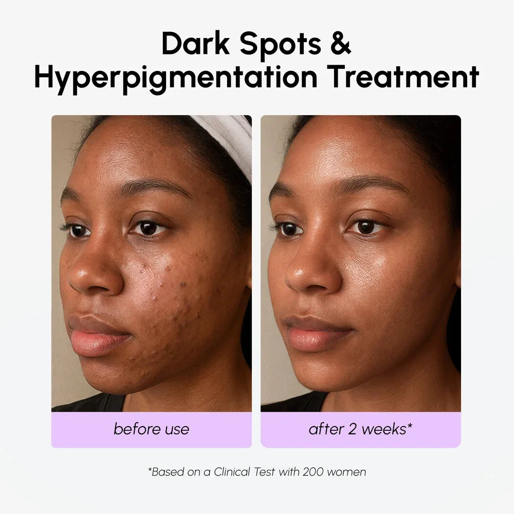 20% Tranexamic Acid Face Serum for Dark Spot Correction - Image 5