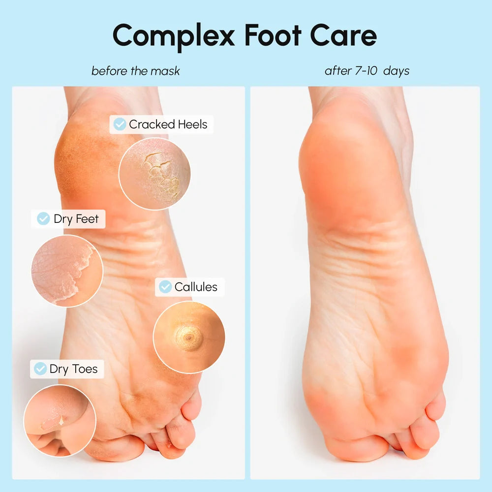 3-in-1 Coconut Oil Hydrating Foot Peel Mask for Smooth Feet - Image 3