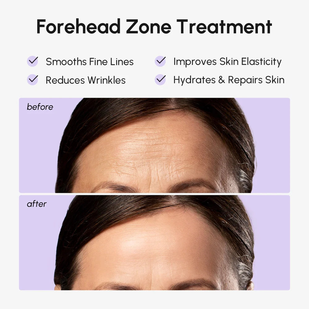 Collagen Forehead Wrinkle Patches for Smoothing and Skin Firming - Image 3