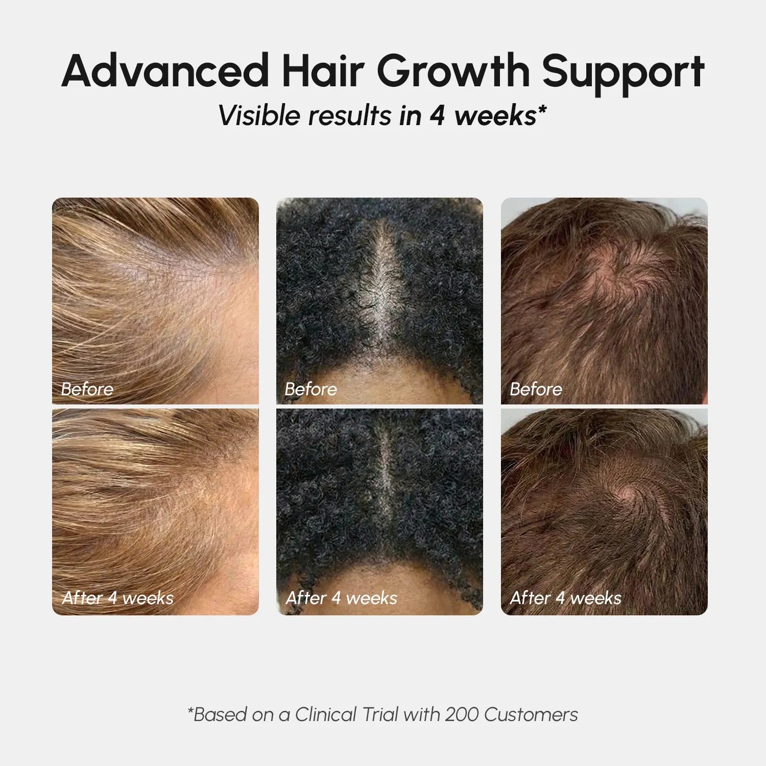 4-in-1 Hair Growth Spray with Biotin and Rosemary Oil 75ml - Image 3