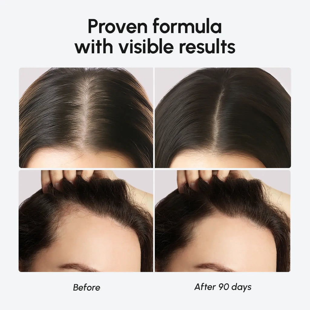 Biotin & Collagen Hair Growth Complex