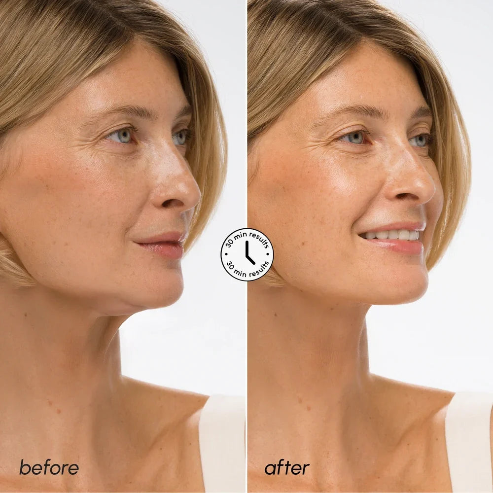 Hyaluronic Acid V-line Lifting Mask for Firm Jawline and Neck - Image 3