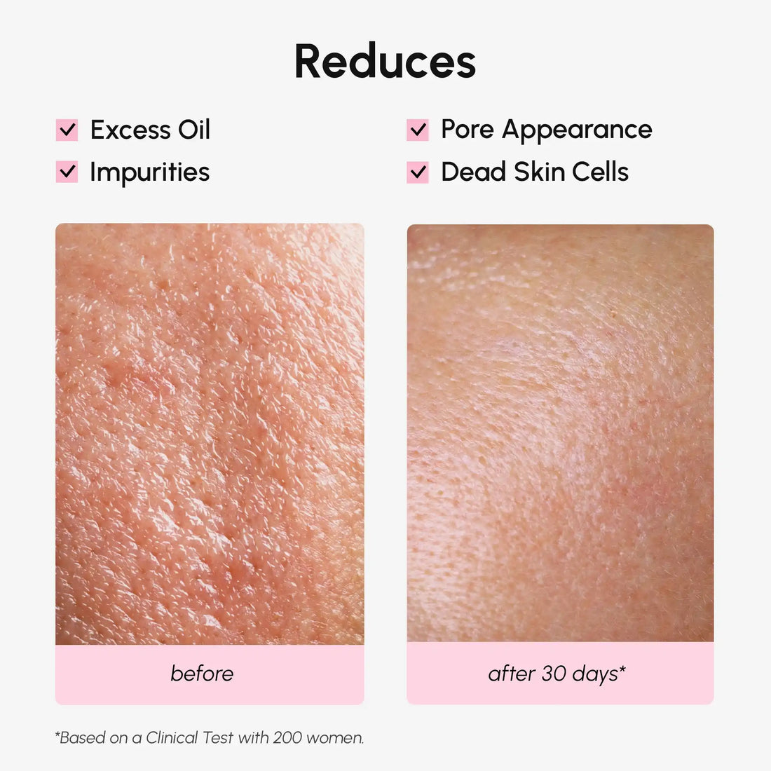 Pore Minimizing Face Toner with Niacinamide and Witch Hazel - Image 4