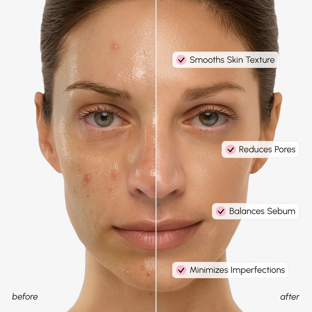 Pore Minimizing Face Toner with Niacinamide and Witch Hazel - Image 7