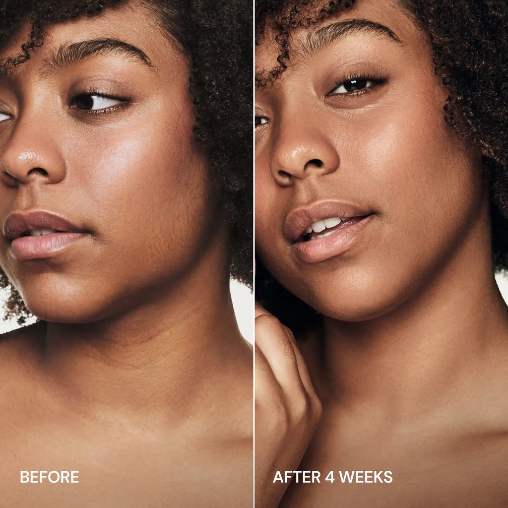 Retinol Neck Firming Cream with Built-in Massaging Applicator - Image 7