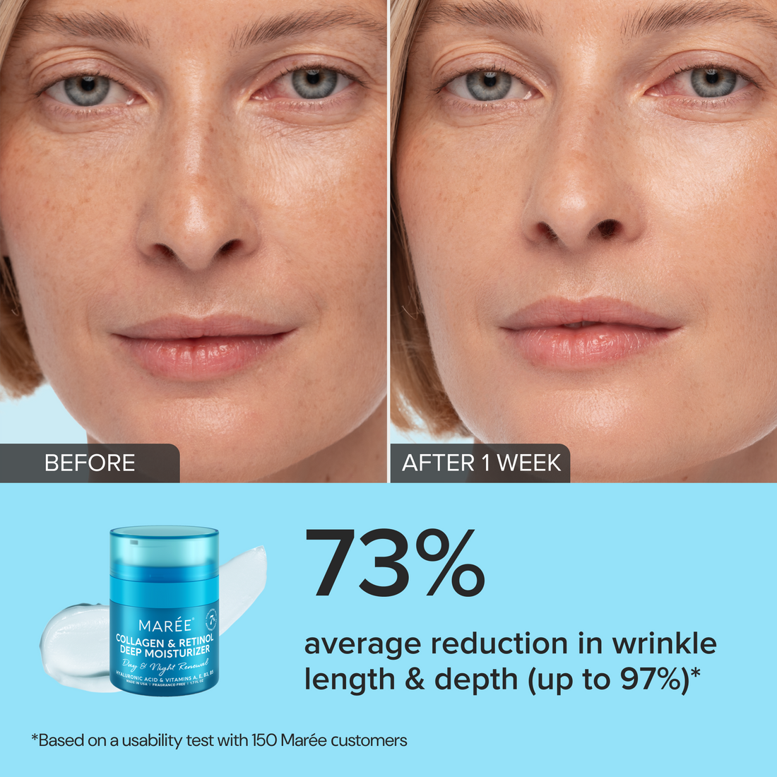 Collagen and Retinol Deep Face Moisturizer Day and Night Cream - Image 2