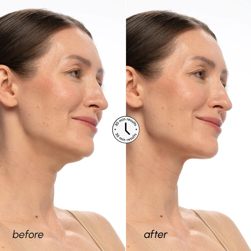 PDRN Salmon DNA Chin & Neck Lifting Mask Set - Image 3