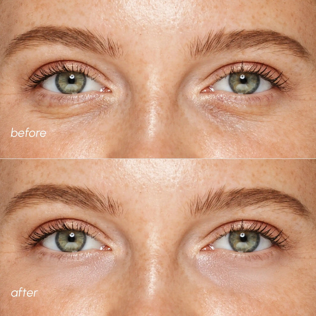 Pearl Radiance Marine Collagen Eye Patches for Depuffing - Image 4