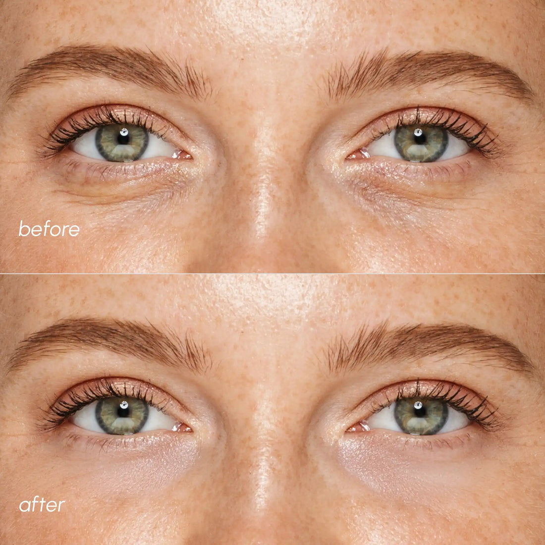 Pearl Radiance Marine Collagen Eye Patches for Depuffing - Image 4