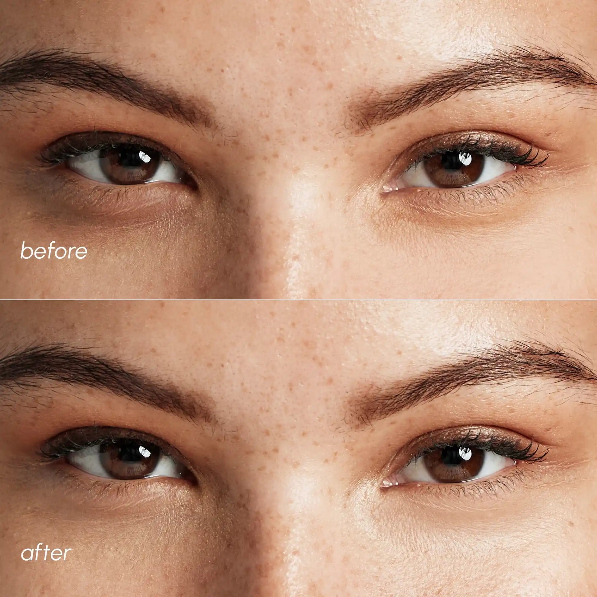 Pearl Radiance Marine Collagen Eye Patches for Depuffing - Image 6