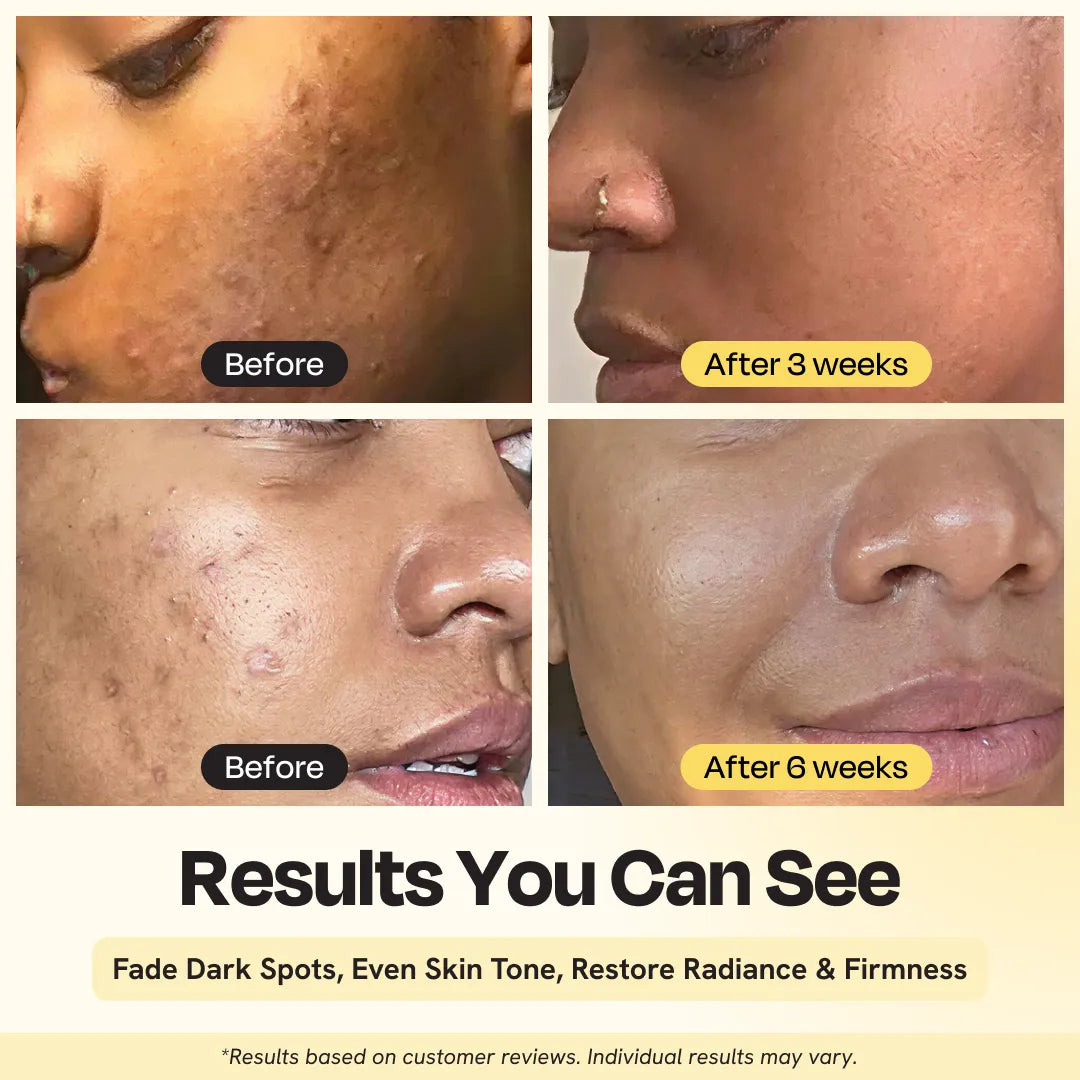 Superactive Serum with 15% Vitamin C for Brighter Even Skin Tone - Image 4