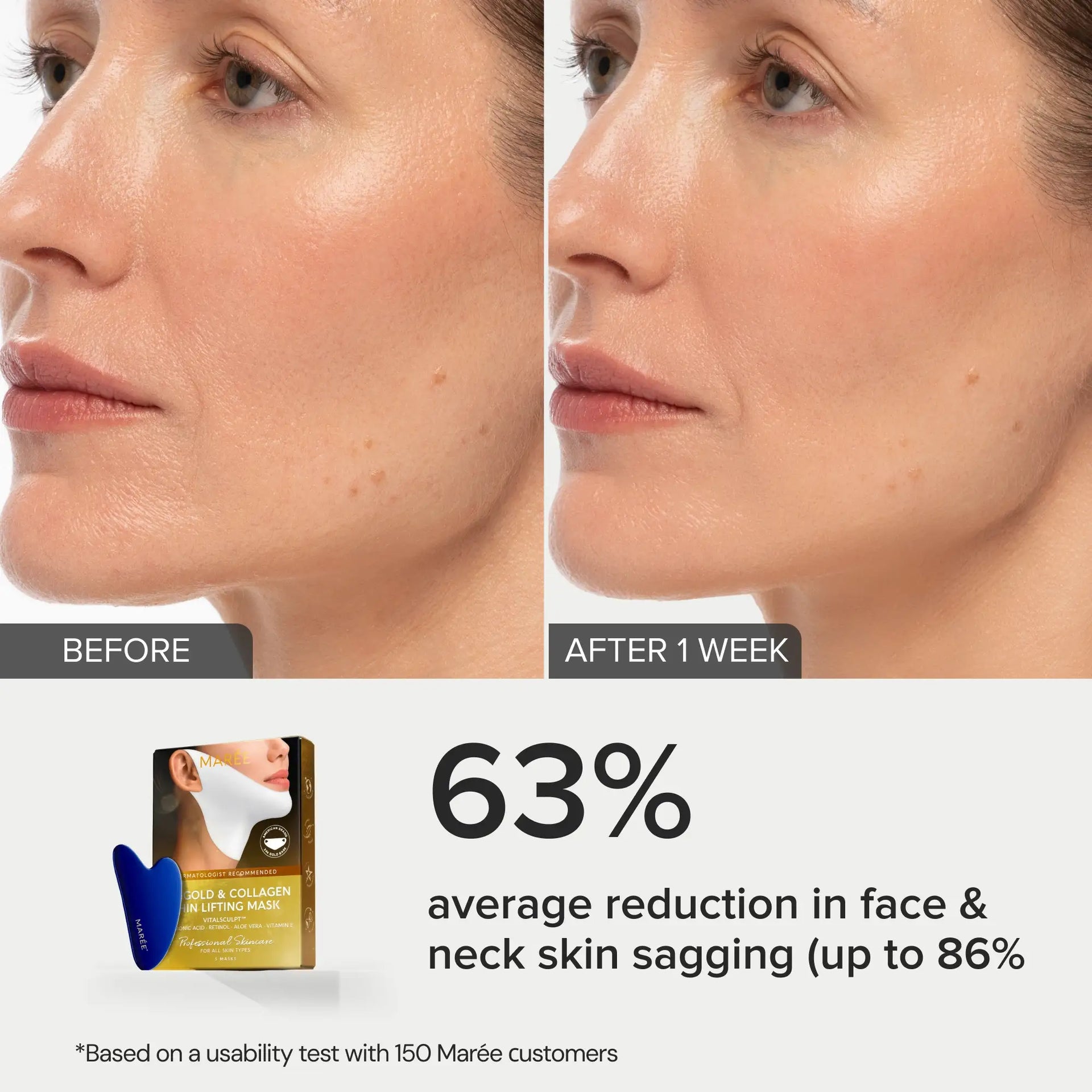 24K Gold Collagen V-Line Lifting Mask for Jawline and Neck - Image 7