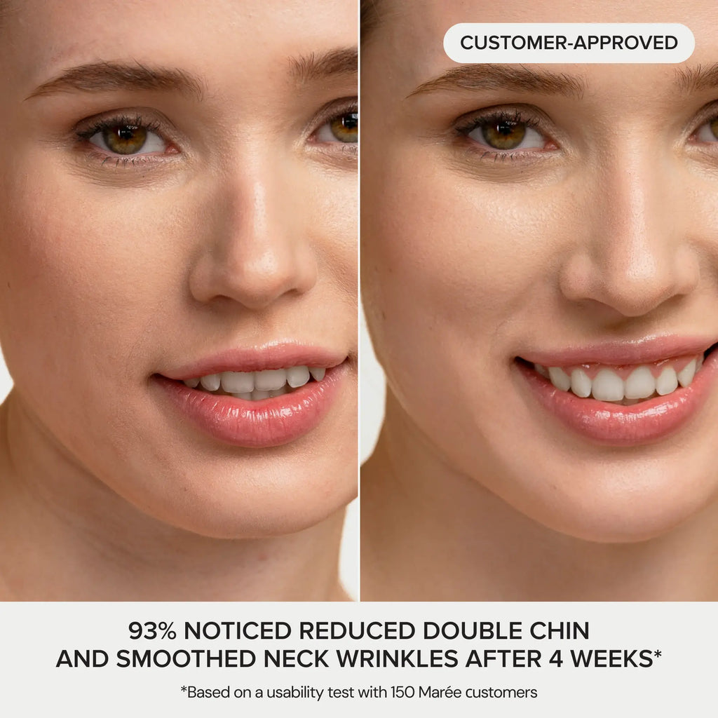 24K Gold Collagen V-Line Lifting Mask for Jawline and Neck - Image 10