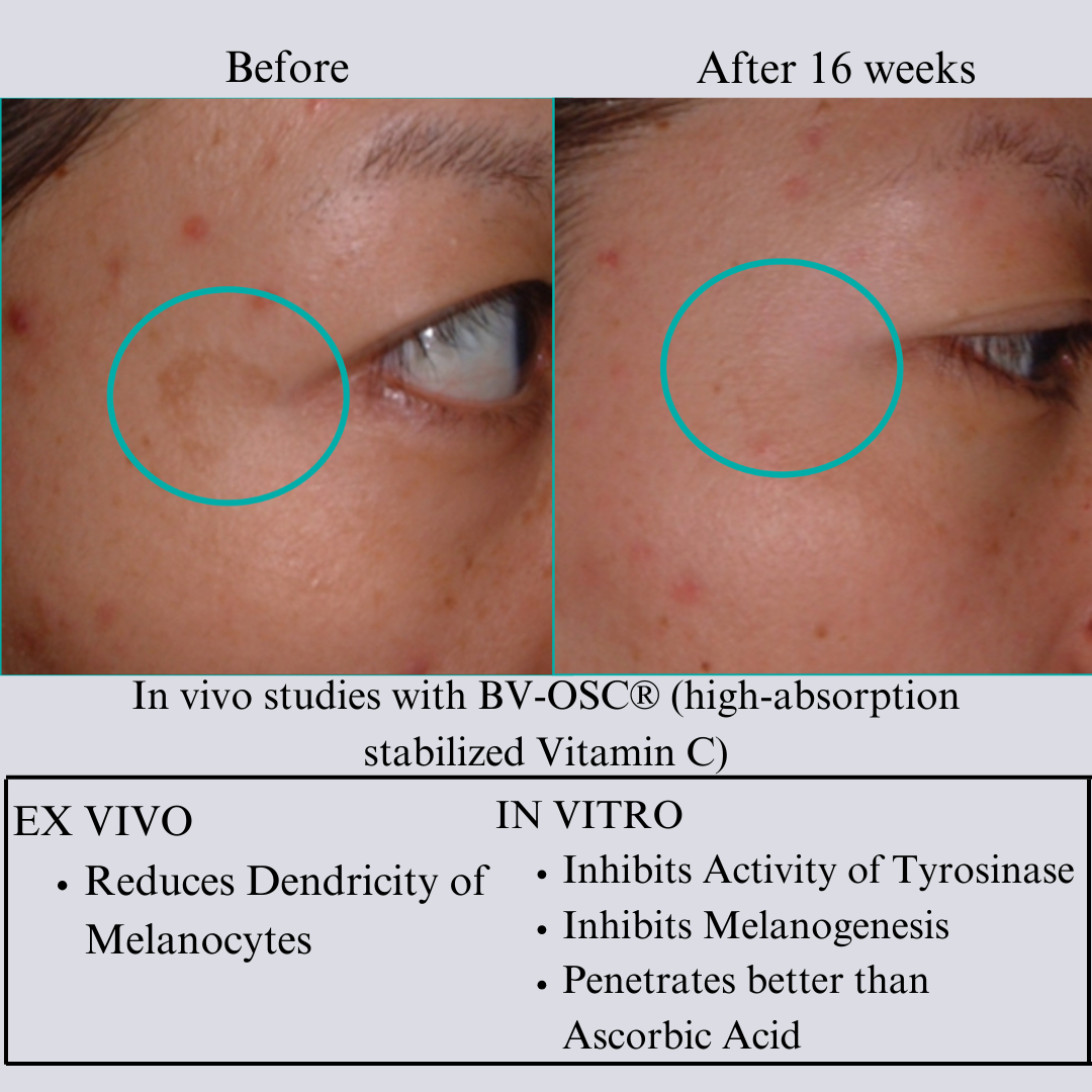 TIGHT AND BRIGHT, an Advanced Gentle Phyto-Retinol and Vitamin C Face Serum, 12 Innovative Technologies, 55% High-Performance Cosmeceuticals