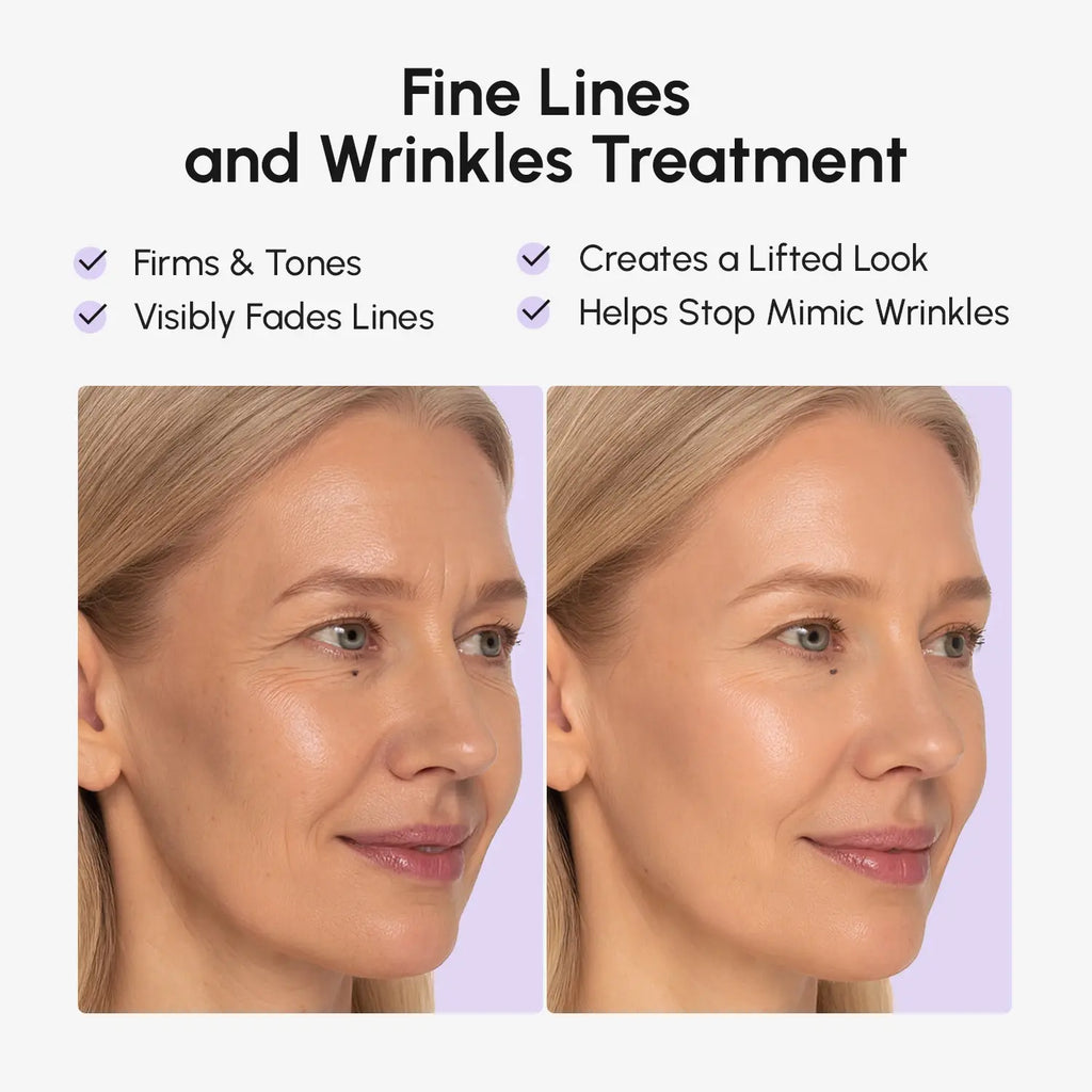 Anti-Wrinkle Face Lift Tape Patches for Smoothing Expression Lines - Image 3