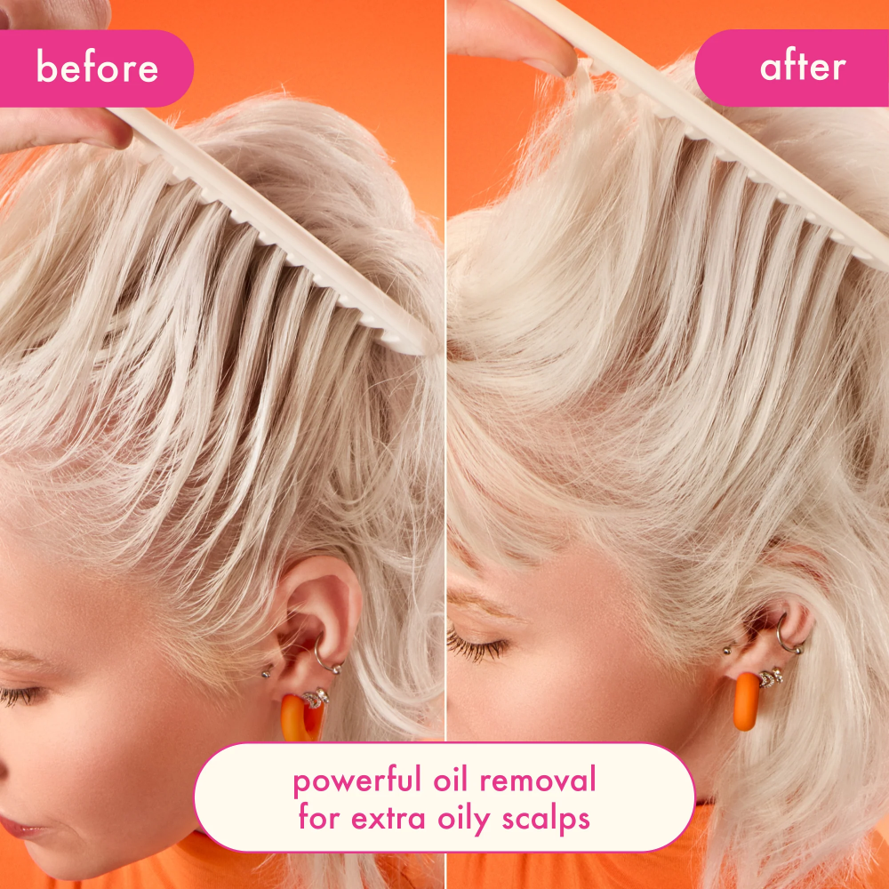 Perk Up Ultra Oil Control Dry Shampoo for Oily Scalp & Hair