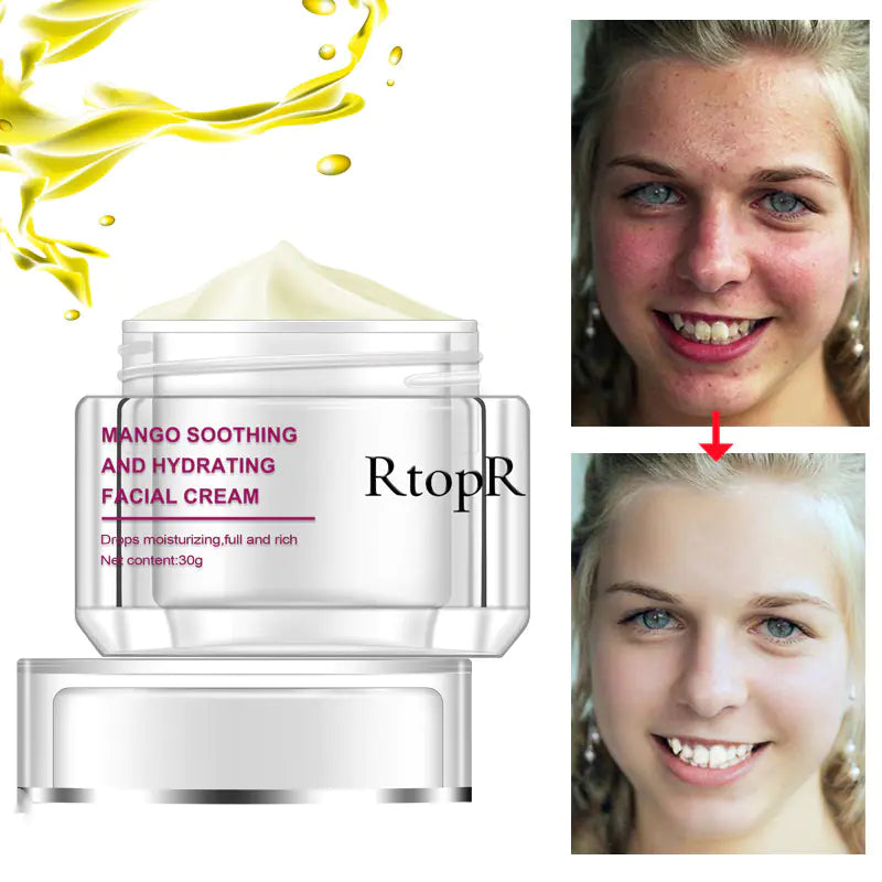RtopR Moisturizing Cream - International Trade Product