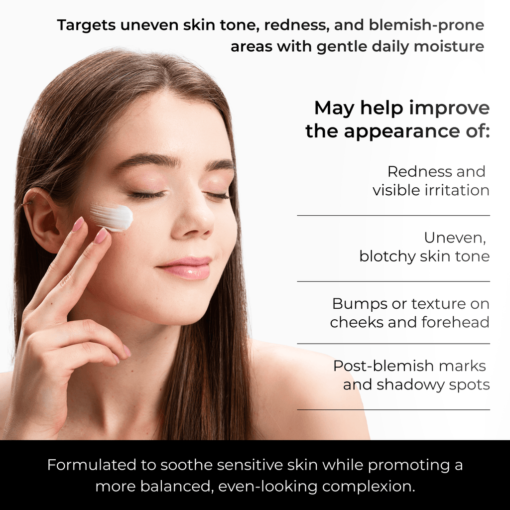 10% Azelaic Acid Cream for Sensitive Skin with Hyaluronic Acid - Image 4