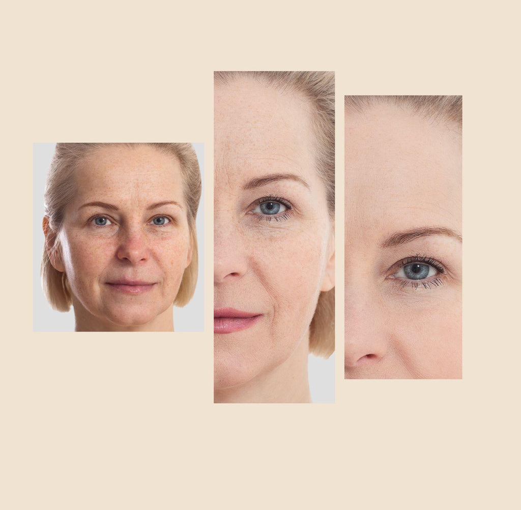 Dark Spot Corrector and Melasma Fade Cream